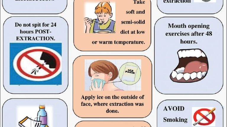 Post Op Extraction Instructions Printable Free Printable